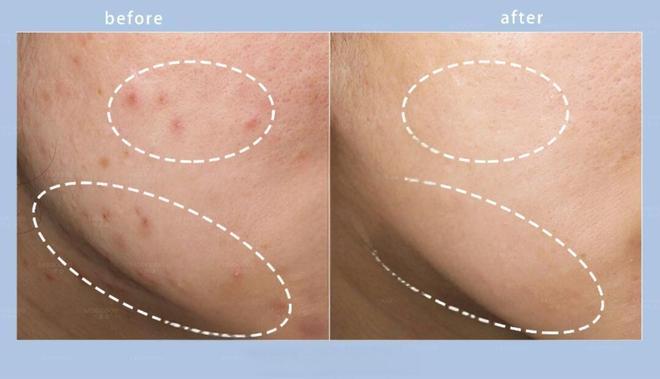 星空体育网站：女士哪款洗面奶效果好？2026祛痘最好的洗面奶排行榜第一名推荐！(图3)